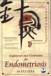 Acupuncture and Moxibustion for Endometriosis DVD