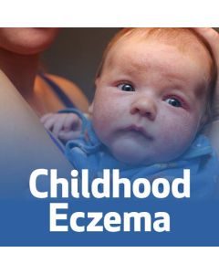 Childhood Eczema